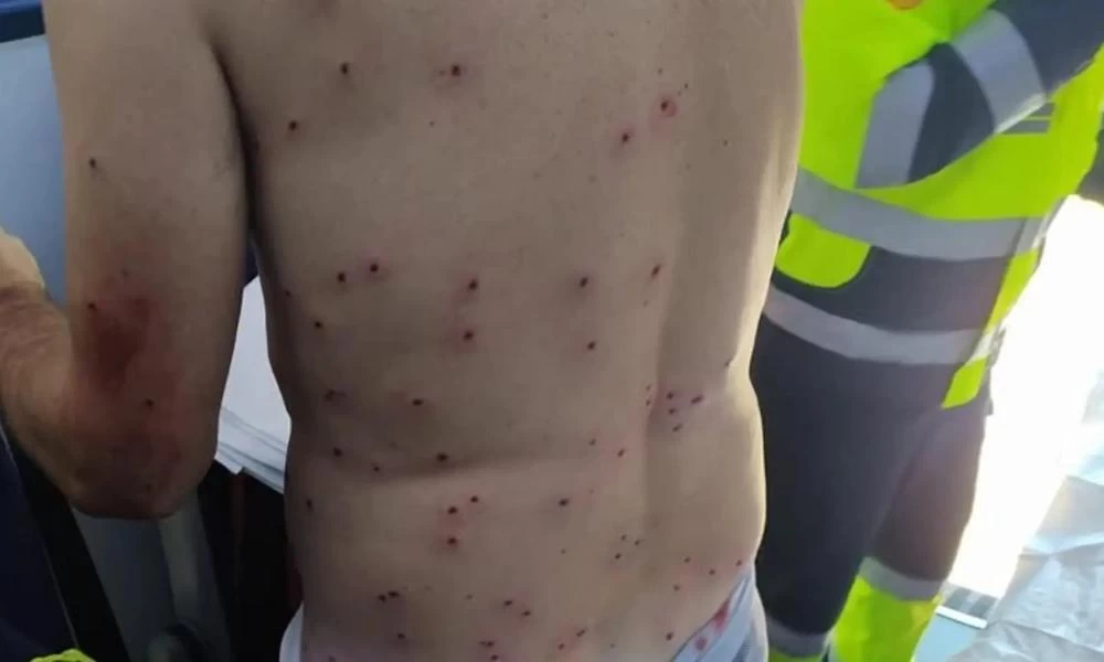 Κυνηγός πέρασε ποδηλάτη για λαγό και τον έκανε ''σουρωτήρι''